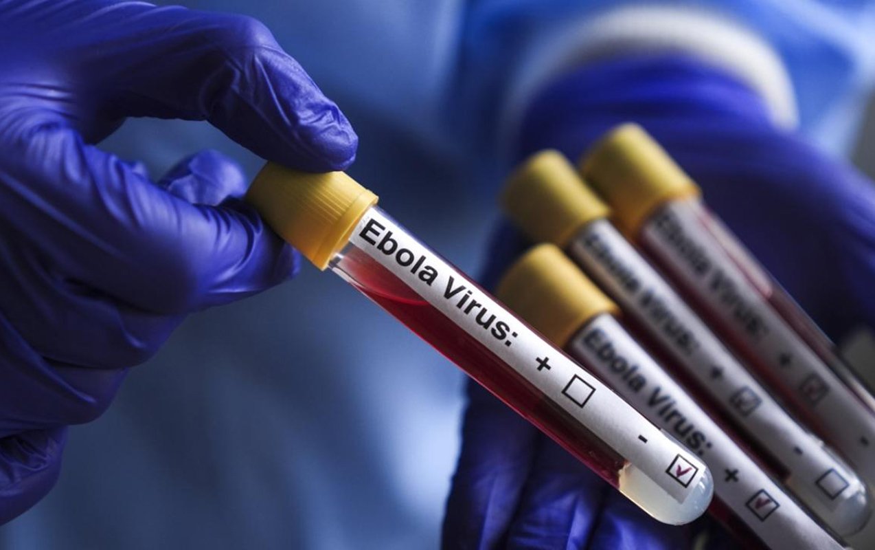 abş-dən ebola ilə bağlı - xəbərdarlıq